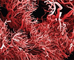 Разрастание сети капилляров в опхолевыых тканях. (кликните картинку для увеличения)