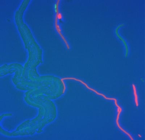 Флюоресцентная микрофотография взаимодейсвия хищник-жертва. Клетки хищников окрашены зеленым. Красные клетки - жертва. (Автор Хао Сонг) (кликните картинку для увеличения)
