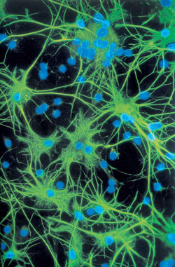 Клетки коры головного мозга 