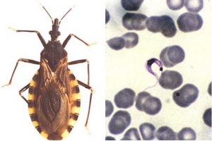 Переносчик болезни Шагаса - <i>Triatoma infestans</i> (слева); возбудитель болезни Шагаса - <i>Trypanosoma cruzi</i> (справа, в центре) (Изображение: http://www.k-state.edu/ и 
http://www.scielo.br/)  (кликните картинку для увеличения)