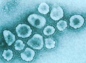 Вирусные частицы – представители семейства Coronaviridae имеют неправильную форму 60-220 нм в диаметре. 
 (кликните картинку для увеличения)