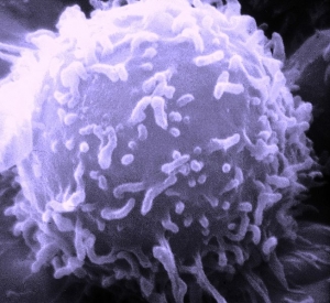 Лимфоцит - компонент иммунной системы человека. Изображение сделано сканирующим электронным микроскопом (с wiki.org) (кликните картинку для увеличения)