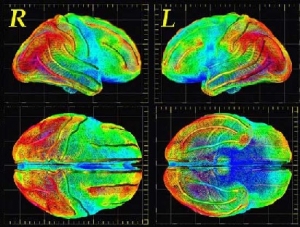 Томография головного мозга (http://krank.ru/) (кликните картинку для увеличения)