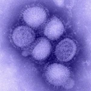 Фотография вируса свиного гриппа (http://www.sciencedaily.com/) 