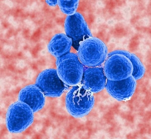 Гроздь Streptoccoccus pneumoniae. (кликните картинку для увеличения)