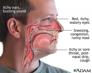 Симптомы аллергии: красные, чешущиеся глаза, текущие из глаз слёзы, насморк, затруднение дыхания через нос, кашель, зуд в горле. (кликните картинку для увеличения)