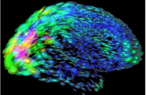 С помощью «выключения» клеток мозга учёные, возможно, научатся лечить болезнь Паркинсона. (кликните картинку для увеличения)