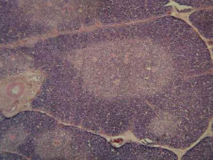 Микрофотография тканей вилочковой железы. (кликните картинку для увеличения)