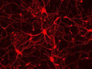 Красным цветом на рисунке выделены эмбриональные мышиные фибробласты, превращённые с помощью трёх генов в нейроны.