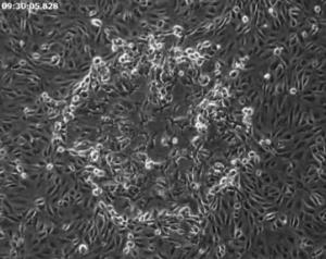 Снимок, на котором видно, как вирус осповакцины распространяется вокруг клеток организма хозяина.