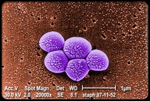 Фотография колонии метициллин резистентного Золотистого стафилококка (МРЗС). (кликните картинку для увеличения)