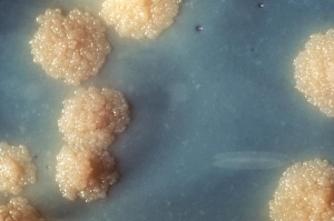 Колонии Mycobacterium tuberculosis. Данный вид микроорганизмов является возбудителем туберкулёза. (кликните картинку для увеличения)