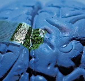 Электродные сети на основе шелка расположенные на модели головного мозга. (кликните картинку для увеличения)
