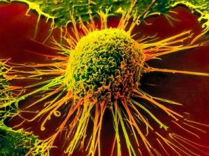 Раковая клетка. (кликните картинку для увеличения)
