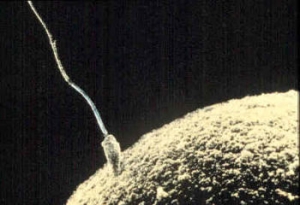 Сперматозоид, пытающийся проникнуть в яйцеклетку. (кликните картинку для увеличения)