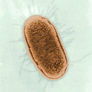 Escherichia coli.