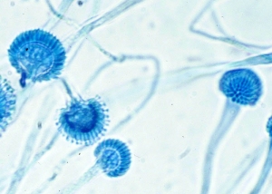 Изображение Aspergillus fumigatus под микроскопом. (кликните картинку для увеличения)
