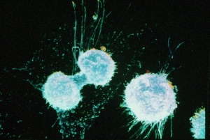 Деление клеток, образующих ткань опухоль яичников. (кликните картинку для увеличения)