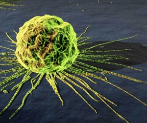 Изображение клетки опухолевой ткани. (кликните картинку для увеличения)
