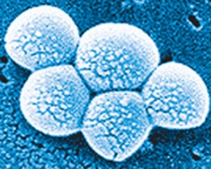Бактерии Staphylococcus aureus. (кликните картинку для увеличения)