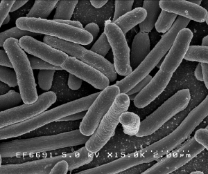 Фотография кишечных палочек – представителей микрофлоры кишечника человека. (кликните картинку для увеличения)