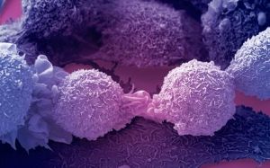 Микрофотография раковых клеток. (кликните картинку для увеличения)
