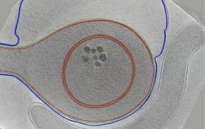 Изображение, полученное при электронной криотомографии. На нём видна Acetonema longum во время споруляции. Материнская клетка охватывает дочернюю клетку, из которой после образуется спора. Внутренняя мембрана выделена красным цветом. Наружная – синим. (кликните картинку для увеличения)