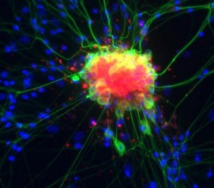 Нейроны (выделены зелёным цветом) и глиальные клетки изолированных дорсальных корешковых ганглиев экспрессируют ЦОГ-2 (выделена красным цветом) после воздействия воспалительных стимулов. (кликните картинку для увеличения)