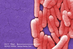 Микрофотография представителей рода Salmonella. (кликните картинку для увеличения)