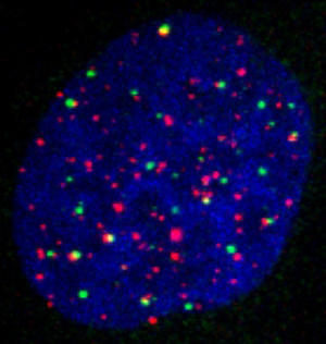 В некоторых опухолевых клетках АЯТ-комплексы (жёлтые), индуцируют удлинение теломерных участков (красные).