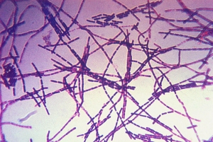 Микрофотография <i> Bacillus anthracis</i>. (кликните картинку для увеличения)