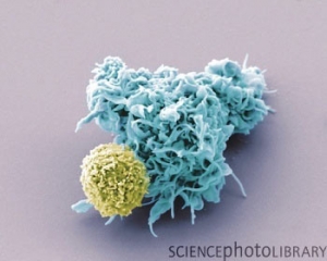 Дендритная клетка (синий), взаимодействующая с T-клеткой (золотой). (кликните картинку для увеличения)
