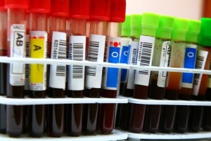 Авторы исследования предполагают, что полученные ими результаты затрагивают вопрос эволюции групп крови: зачем человеку разные группы крови? (кликните картинку для увеличения)