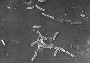 Микроснимок бактерий <i>Pseudomonas aeruginosa</i>. (кликните картинку для увеличения)