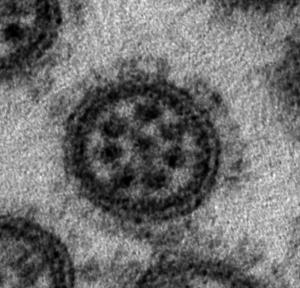 Формирующийся вирус гриппа А.
