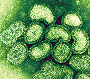Вирусные частицы H1N1. (кликните картинку для увеличения)