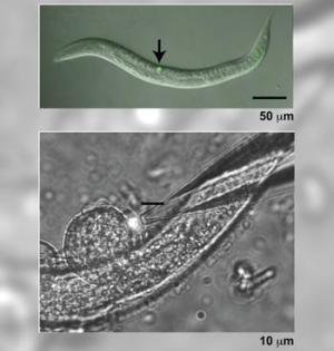 В верхней части снимка стрелкой указана группа мигрирующих клеток в организме нематоды. В нижней части снимка показано выделение мигрирующих клеток из организма червя с помощью стеклянной пипетки.
