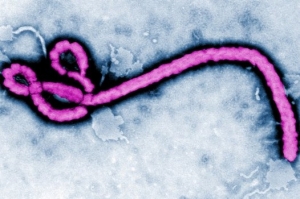 Изображение вируса Эбола. (кликните картинку для увеличения)