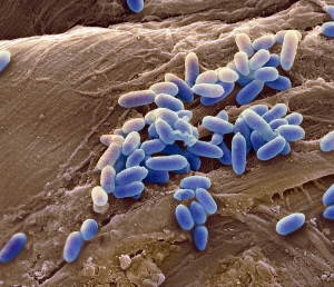 Бактерии <i>Pseudomonas aeruginosa</i>. (кликните картинку для увеличения)