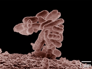 Скопление бактерий вида <i>E. coli</i>. (кликните картинку для увеличения)