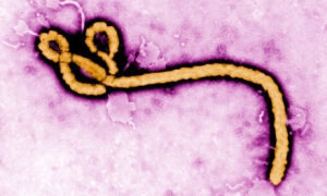 Фотография вируса Эбола. (кликните картинку для увеличения)