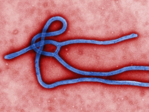 Вирус Эбола — общее название вирусов рода <i>Ebolavirus</i>, вызывающих гемморагическую лихорадку Эбола у высших приматов. (кликните картинку для увеличения)