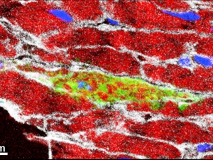 Изображение участка ткани сердца мыши. В средней части изображения зелёным цветом выделены клетки, возникшие из стволовых клеток <i>Sca1</i>. (кликните картинку для увеличения)