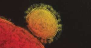 Фотография коронавируса MERS (запечатлён процесс инфекции клетки). (кликните картинку для увеличения)