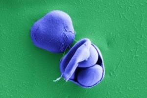 Фотография асков и располагающихся в них спор дрожжей <i>Saccharomyces paradoxus</i>. (кликните картинку для увеличения)