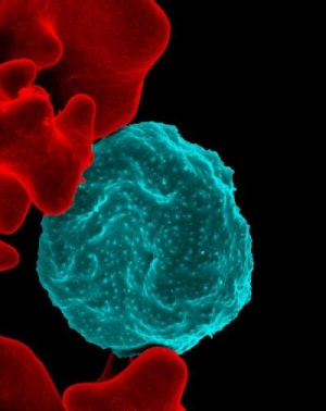 Микрофотография, на которой показан эритроцит, инфицированный малярийным паразитом (выделен голубым цветом). Слева от него видны незаражённые клетки с гладкой красной поверхностью. (кликните картинку для увеличения)