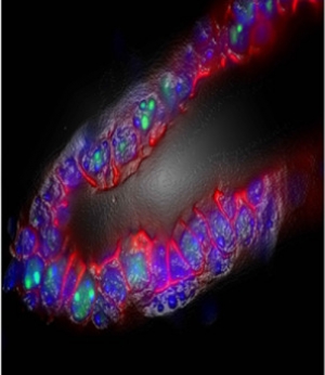 На фото изображена молочная железа мыши, в которой не экспрессируется <i>р53</i>. Видна экспрессия <i>ARF</i> (области, выделенные зелёным цветом). (кликните картинку для увеличения)