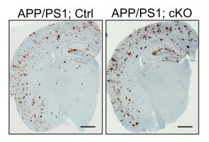 Потеря ЛРП6 в нейронах ведёт к усиленному отложению амилоидного белка — маркера болезни Альцгеймера. (кликните картинку для увеличения)