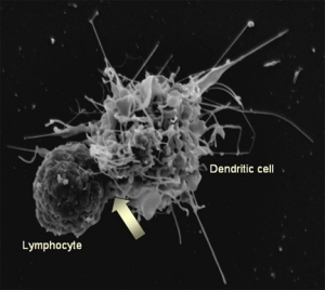 Лимфоцит и дендритная клетка. (кликните картинку для увеличения)