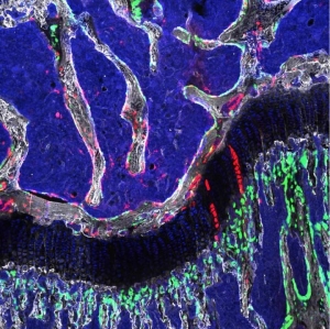 Изображение головки бедренной кости. Остеохондроретикулярные стволовые клетки выделены красным. (кликните картинку для увеличения)